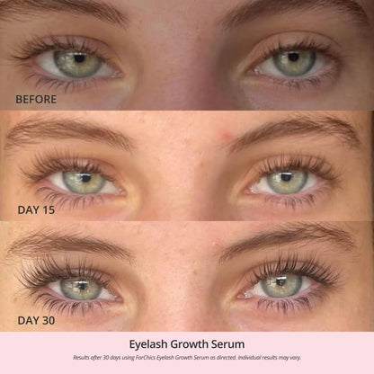 Aluvive™ Eyelash Growth Serum