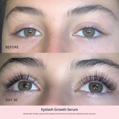 Aluvive™ Eyelash Growth Serum